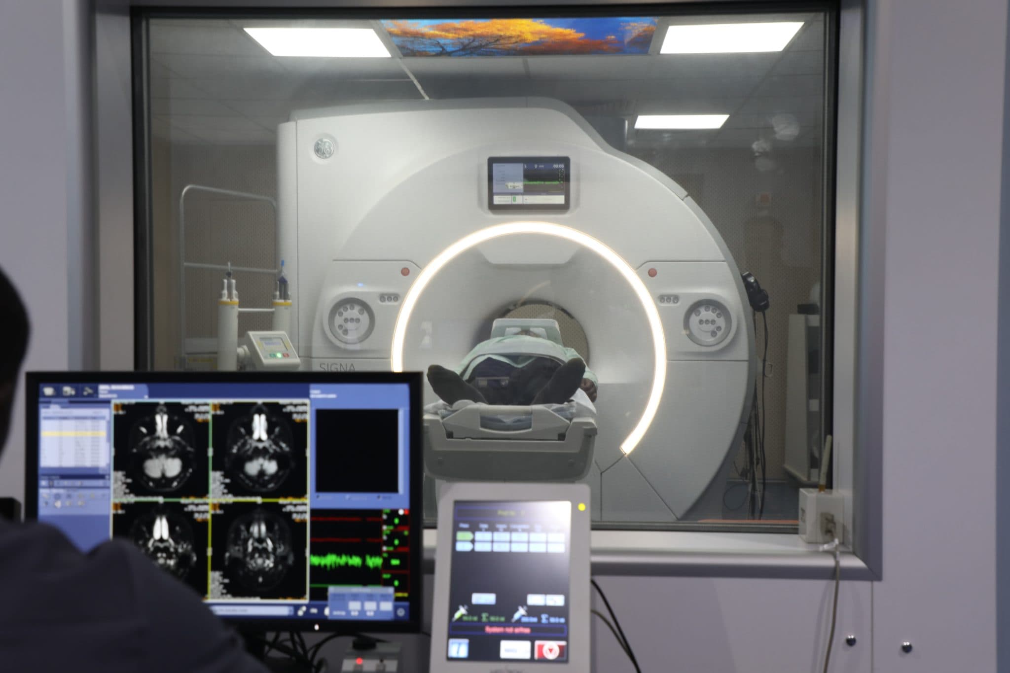 MRI (Magnetic Resonance Imaging)
